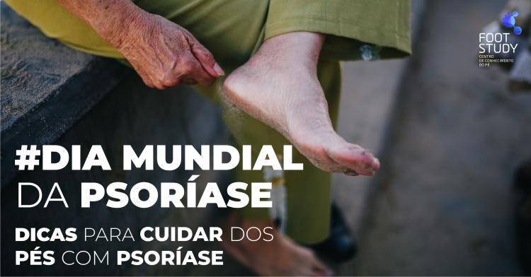 TIPS FOR PSORIASIS FEET CARE